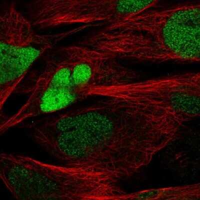 Immunocytochemistry/ Immunofluorescence: SOX8 Antibody [NBP2-54978]