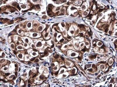 Immunohistochemistry-Paraffin: SOX8 Antibody [NBP3-12898]
