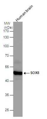 Western Blot: SOX8 Antibody [NBP3-12898]