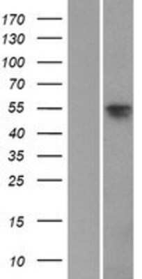 Western Blot: SOX8 Overexpression Lysate [NBP2-07314]