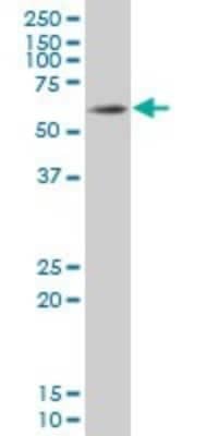 Western Blot: SOX9 Antibody (3C10) [H00006662-M02]