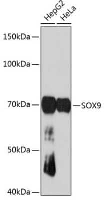 Western Blot: SOX9 Antibody (5Y4J8) [NBP3-15875]