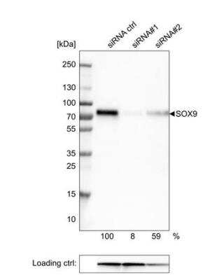 Western Blot: SOX9 Antibody (CL0639) [NBP2-52943]