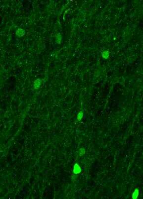 Immunohistochemistry-Frozen: SOX9 Antibody [NBP2-24659]