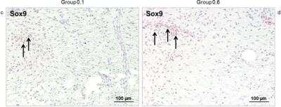 Immunohistochemistry: SOX9 Antibody [NBP2-24659]