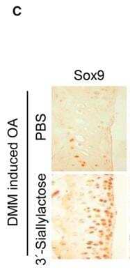 Immunohistochemistry: SOX9 Antibody [NBP2-24659]