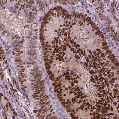 Immunohistochemistry-Paraffin: SOX9 Antibody [NBP1-85551]