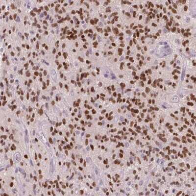 Immunohistochemistry-Paraffin: SOX9 Antibody [NBP1-85551]
