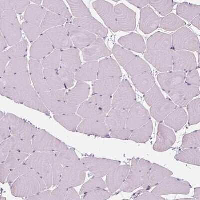 Immunohistochemistry-Paraffin: SOX9 Antibody [NBP1-85551]