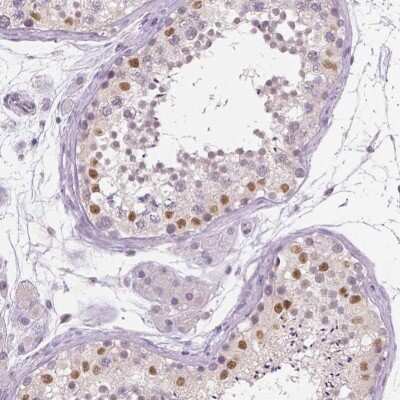 Immunohistochemistry-Paraffin: SOX9 Antibody [NBP1-85551]