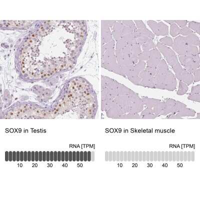 Immunohistochemistry-Paraffin: SOX9 Antibody [NBP1-85551]