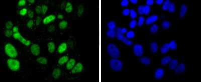 Immunocytochemistry/ Immunofluorescence: SOX9 Antibody (SN74-09) [NBP2-67690]