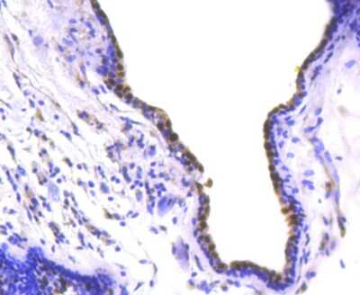 Immunohistochemistry-Paraffin: SOX9 Antibody (SN74-09) [NBP2-67690]