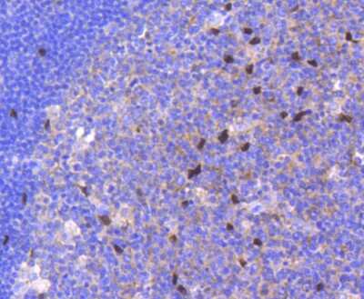 Immunohistochemistry-Paraffin: SOX9 Antibody (SN74-09) [NBP2-67690]