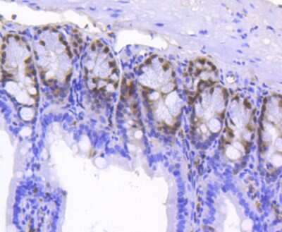 Immunohistochemistry-Paraffin: SOX9 Antibody (SN74-09) [NBP2-67690]