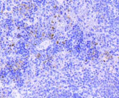 Immunohistochemistry-Paraffin: SOX9 Antibody (SN74-09) [NBP2-67690]