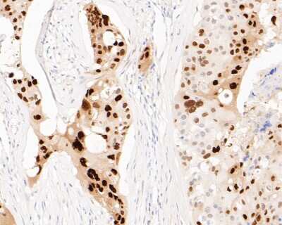 Immunohistochemistry-Paraffin: SOX9 Antibody (SN74-09) [NBP2-67690]