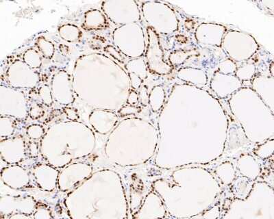 Immunohistochemistry-Paraffin: SOX9 Antibody (SN74-09) [NBP2-67690]
