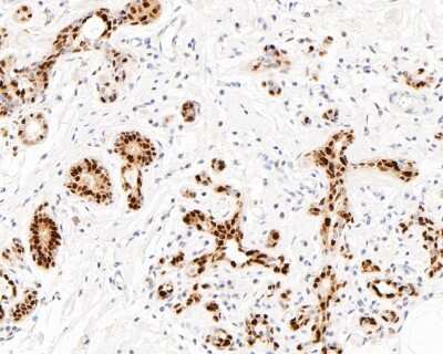 Immunohistochemistry-Paraffin: SOX9 Antibody (SN74-09) [NBP2-67690]