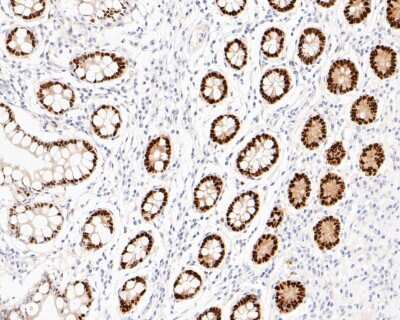 Immunohistochemistry-Paraffin: SOX9 Antibody (SN74-09) [NBP2-67690]