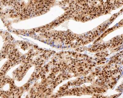 Immunohistochemistry-Paraffin: SOX9 Antibody (SN74-09) [NBP2-67690]