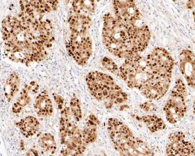 Immunohistochemistry-Paraffin: SOX9 Antibody (SN74-09) [NBP2-67690]