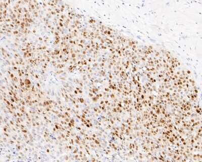 Immunohistochemistry-Paraffin: SOX9 Antibody (SN74-09) [NBP2-67690]