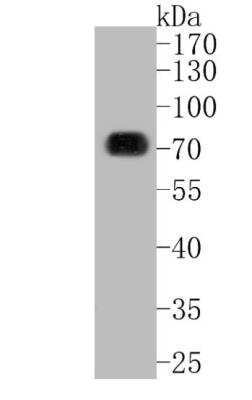 Western Blot: SOX9 Antibody (SN74-09) [NBP2-67690]