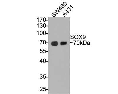 Western Blot: SOX9 Antibody (SN74-09) [NBP2-67690]