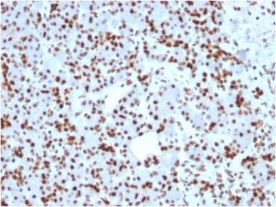 Immunohistochemistry-Paraffin: SOX9 Antibody (SOX9/2398) [NBP3-07659]