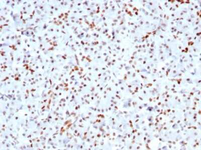 Immunohistochemistry-Paraffin: SOX9 Antibody (SOX9/3141R) [NBP3-07687]