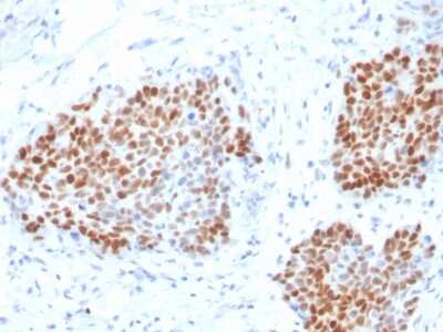 Immunohistochemistry-Paraffin: SOX9 Antibody (SOX9/3916R) - Azide and BSA Free [NBP3-08400]