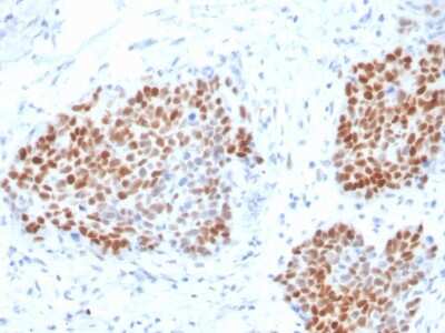 Immunohistochemistry-Paraffin: SOX9 Antibody (SOX9/3916R) [NBP3-07660]