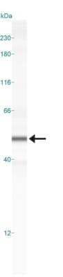 Simple Western: SOX9 Antibody [NBP2-24659]