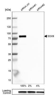 Knockdown Validated: SOX9 Antibody [NBP1-85551]