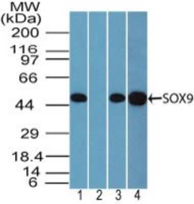 Western Blot: SOX9 Antibody [NBP2-24659]