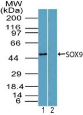 Western Blot: SOX9 Antibody [NBP2-24659]