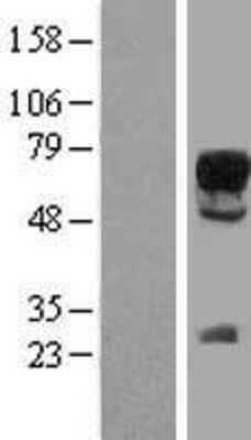 Western Blot: SOX9 Overexpression Lysate [NBP2-09033]