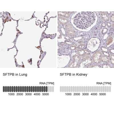 Immunohistochemistry-Paraffin: SP-B/Surfactant Protein B Antibody [NBP2-33982]