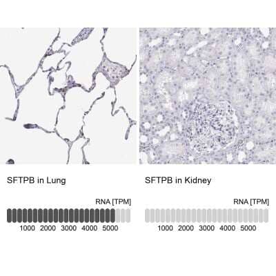 Immunohistochemistry-Paraffin: SP-B/Surfactant Protein B Antibody [NBP2-49359]