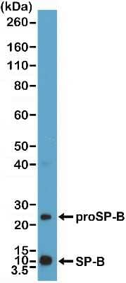 Western Blot: SP-B/Surfactant Protein B Antibody (RM370) [NBP2-77431]