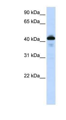 Western Blot: SP-B/Surfactant Protein B Antibody [NBP1-57977]