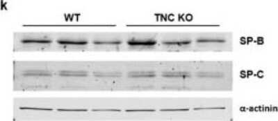 Western Blot: SP-B/Surfactant Protein B Antibody [NBP1-57977]