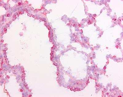 Immunohistochemistry-Paraffin: SP-D Antibody (1.7) - BSA Free [NBP1-41050]