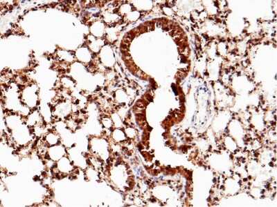 Immunohistochemistry-Paraffin: SP-D Antibody (119) [NBP2-90480]