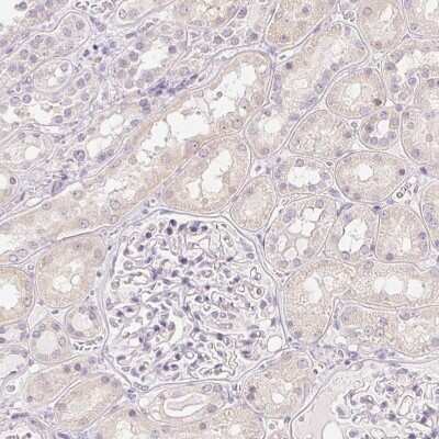 Immunohistochemistry-Paraffin: SP-D Antibody [NBP2-33424]