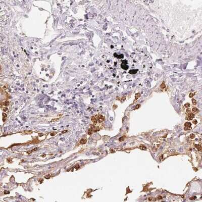 Immunohistochemistry-Paraffin: SP-D Antibody [NBP2-33424]