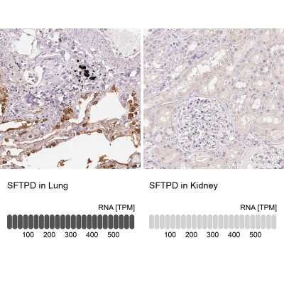Immunohistochemistry-Paraffin: SP-D Antibody [NBP2-33424]