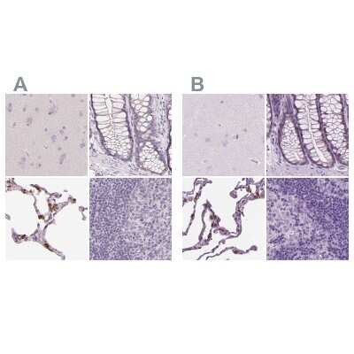 Immunohistochemistry-Paraffin: SP-D Antibody [NBP2-33424]