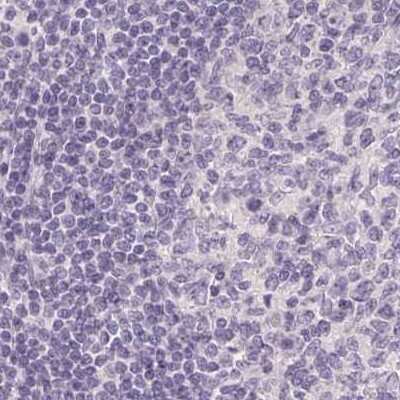 Immunohistochemistry-Paraffin: SP-D Antibody [NBP2-33424]